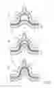 Fig. 03 - MICRODERMABRASION DEVICE