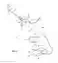 Fig. 07 - Surgical device with incorporated tissue extraction