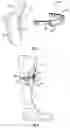 Fig. 02 - Navigation instruments for subchondral bone treatment