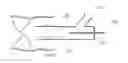 Fig. 01 - Catheter with vessel lining and methods for using same