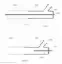 Fig. 09 - Catheter with vessel lining and methods for using same