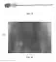 Fig. 04 - Endoscopic fusion system and method with neuromonitoring