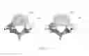 Fig. 07 - Endoscopic fusion system and method with neuromonitoring