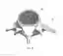Fig. 09 - Endoscopic fusion system and method with neuromonitoring
