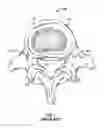 Fig. 02 - Bone screw