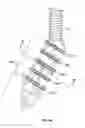 Fig. 07 - Bone screw