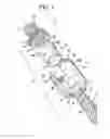 Fig. 02 - Bone anchor assemblies