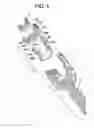 Fig. 06 - Bone anchor assemblies