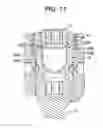Fig. 10 - Bone anchor assemblies