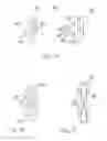Fig. 22 - SPINAL IMPLANTS AND METHODS