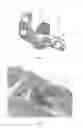 Fig. 02 - Bone fixation devices