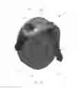Fig. 09 - Bone fixation devices