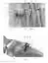 Fig. 10 - Bone fixation devices