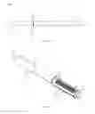 Fig. 22 - Active compression devices, methods of assembly and methods of use