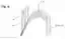 Fig. 06 - Medical fastener