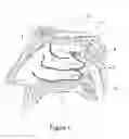 Fig. 02 - Apparatus and methods for treating rhinitis