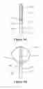 Fig. 06 - Apparatus and methods for treating rhinitis
