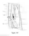 Fig. 22 - Apparatus and methods for treating rhinitis