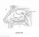 Fig. 43 - Apparatus and methods for treating rhinitis