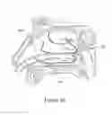 Fig. 44 - Apparatus and methods for treating rhinitis