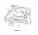 Fig. 45 - Apparatus and methods for treating rhinitis