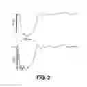 Fig. 03 - Nanoelectroablation control and vaccination