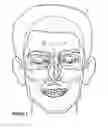 Fig. 03 - System & method for matching the results of a CT scan to a nasal-sinus surgery plan to treat migraine headaches
