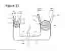Fig. 09 - Articulated handle for mechanical telemanipulator