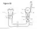 Fig. 33 - Articulated handle for mechanical telemanipulator
