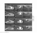 Fig. 22 - Therapeutic tooth bud ablation