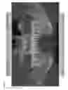Fig. 04 - Method for guiding dental implant plan, apparatus for same, and recording medium therefor