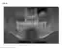 Fig. 09 - Method for guiding dental implant plan, apparatus for same, and recording medium therefor