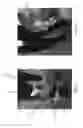 Fig. 02 - BANDAGE