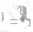 Fig. 07 - Device and method of performing cerclage sacrocervicopexy