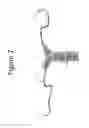 Fig. 08 - Device and method of performing cerclage sacrocervicopexy