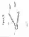 Fig. 22 - Device and method of performing cerclage sacrocervicopexy