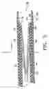 Fig. 03 - Filter delivery system