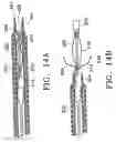 Fig. 15 - Filter delivery system