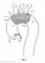 Fig. 04 - Embolic protection device