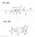 Fig. 05 - Distal protection devices having controllable wire motion