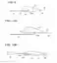 Fig. 06 - Distal protection devices having controllable wire motion