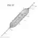 Fig. 22 - Distal protection devices having controllable wire motion