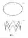 Fig. 28 - Adjustable endolumenal implant for reshaping the mitral valve annulus
