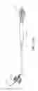 Fig. 35 - Adjustable endolumenal implant for reshaping the mitral valve annulus