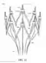 Fig. 37 - Adjustable endolumenal implant for reshaping the mitral valve annulus