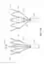 Fig. 41 - Adjustable endolumenal implant for reshaping the mitral valve annulus