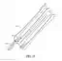 Fig. 48 - Adjustable endolumenal implant for reshaping the mitral valve annulus
