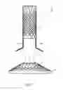 Fig. 08 - Fixation of intraluminal device
