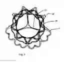 Fig. 08 - METHOD AND DESIGN FOR A MITRAL REGURGITATION TREATMENT DEVICE