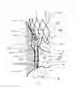 Fig. 01 - HEART VALVE PROSTHESIS WITH OUTER SKIRT